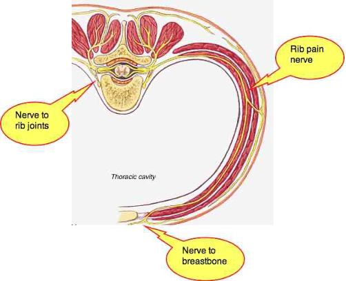 Rib Pain - Dr. Harlan Sparer